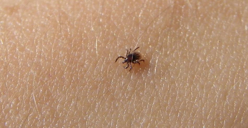 Uwaga na kleszcze! Sprawdź, jak je usuwać i jak się przed nimi bronić